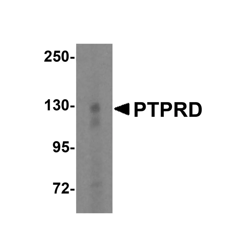 ProSci 6875 PTPRD Antibody, ProSci, 0.1 mg/Unit Primary Image