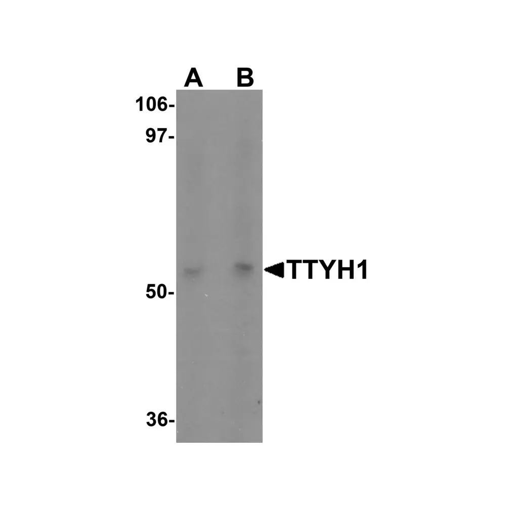 ProSci 6883_S TTYH1 Antibody, ProSci, 0.02 mg/Unit Primary Image
