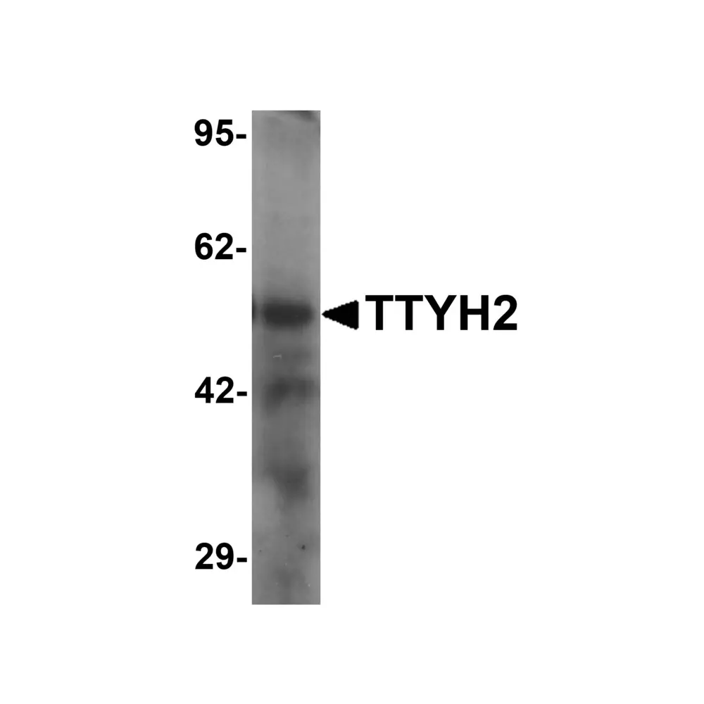 ProSci 6885_S TTYH2 Antibody, ProSci, 0.02 mg/Unit Primary Image