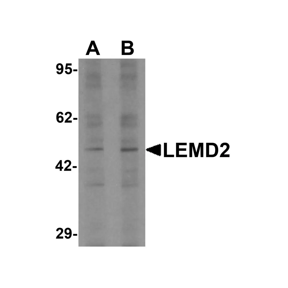 ProSci 6891 LEMD2 Antibody, ProSci, 0.1 mg/Unit Primary Image