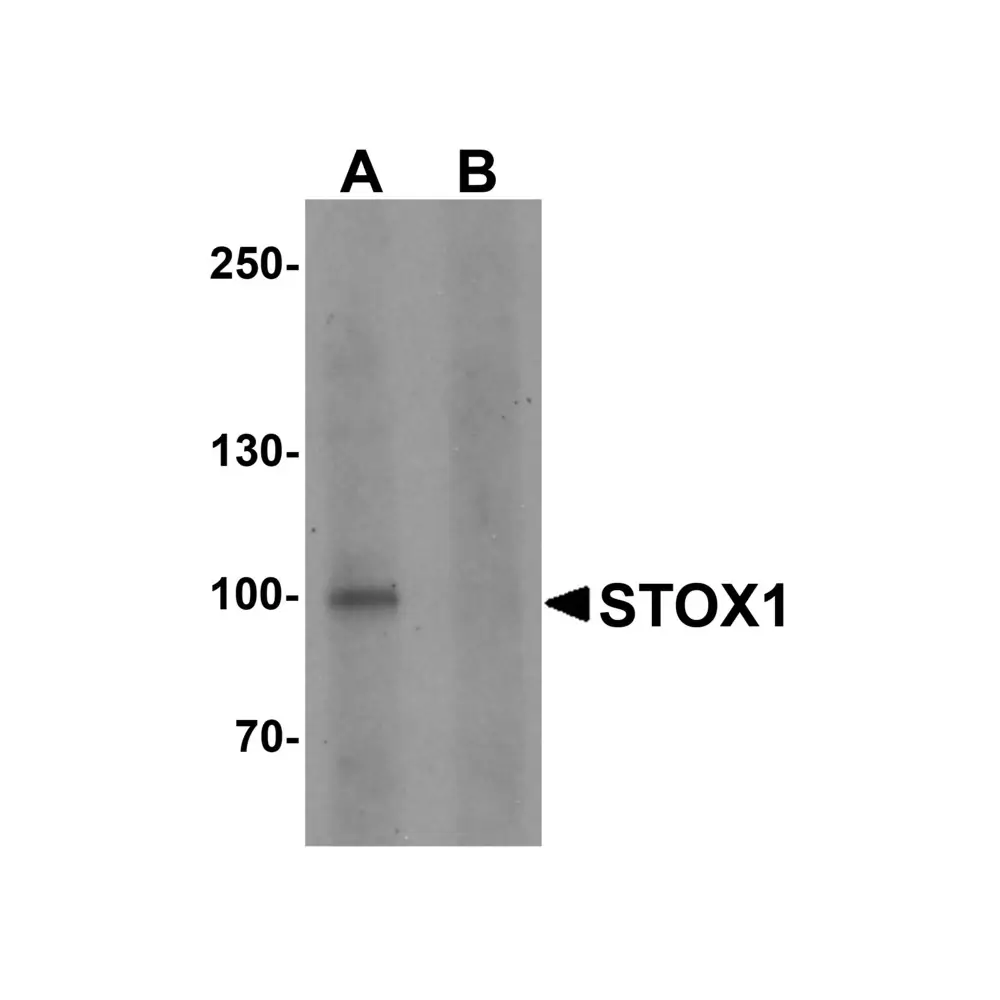 ProSci 6901_S STOX1 Antibody, ProSci, 0.02 mg/Unit Primary Image