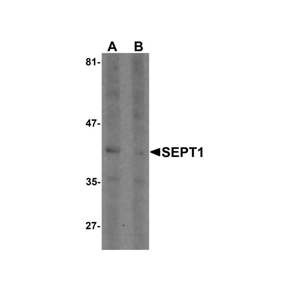 ProSci 6903 SEPT1 Antibody, ProSci, 0.1 mg/Unit Primary Image