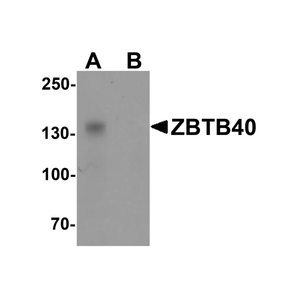 ProSci 6905 ZBTB40 Antibody, ProSci, 0.1 mg/Unit Primary Image