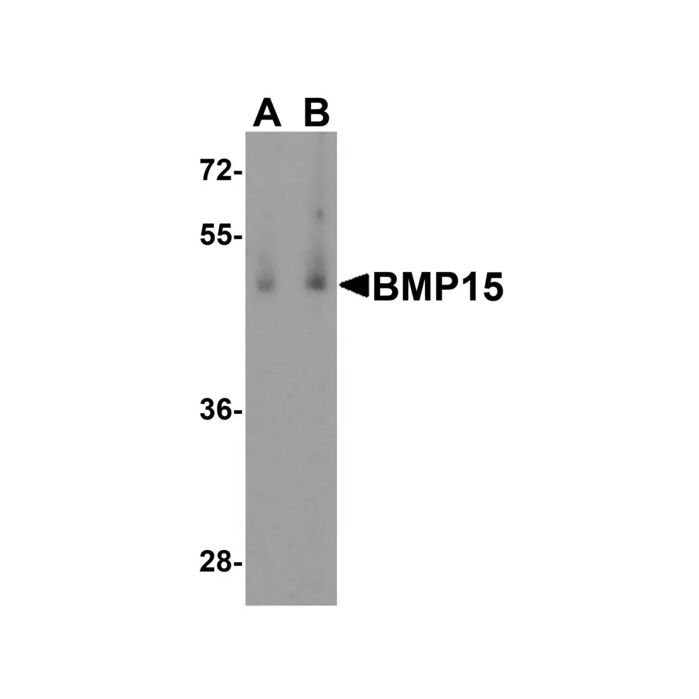 ProSci 6909 BMP15 Antibody, ProSci, 0.1 mg/Unit Primary Image