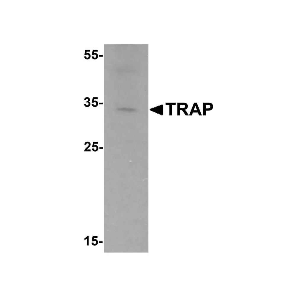 ProSci 6911_S TRAP Antibody, ProSci, 0.02 mg/Unit Primary Image