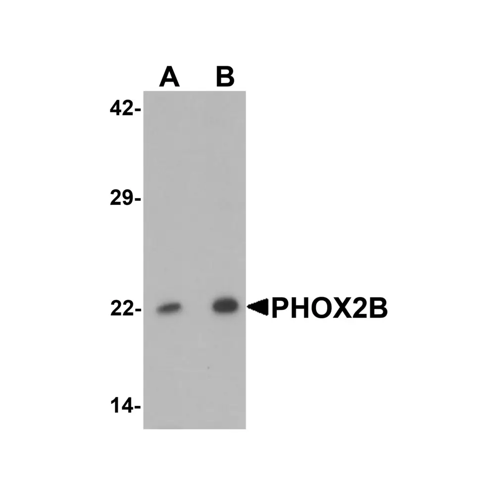 ProSci 6913_S PHOX2B Antibody, ProSci, 0.02 mg/Unit Primary Image