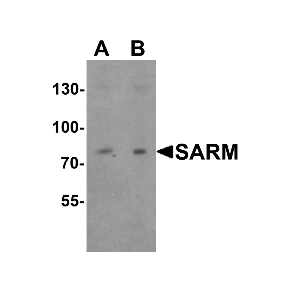 ProSci 6917 SARM Antibody, ProSci, 0.1 mg/Unit Primary Image