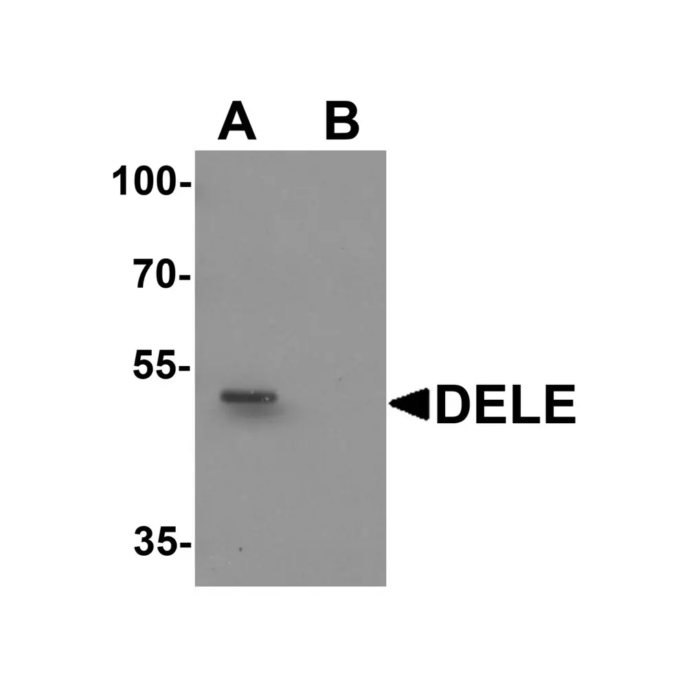 ProSci 6919 DELE Antibody, ProSci, 0.1 mg/Unit Primary Image