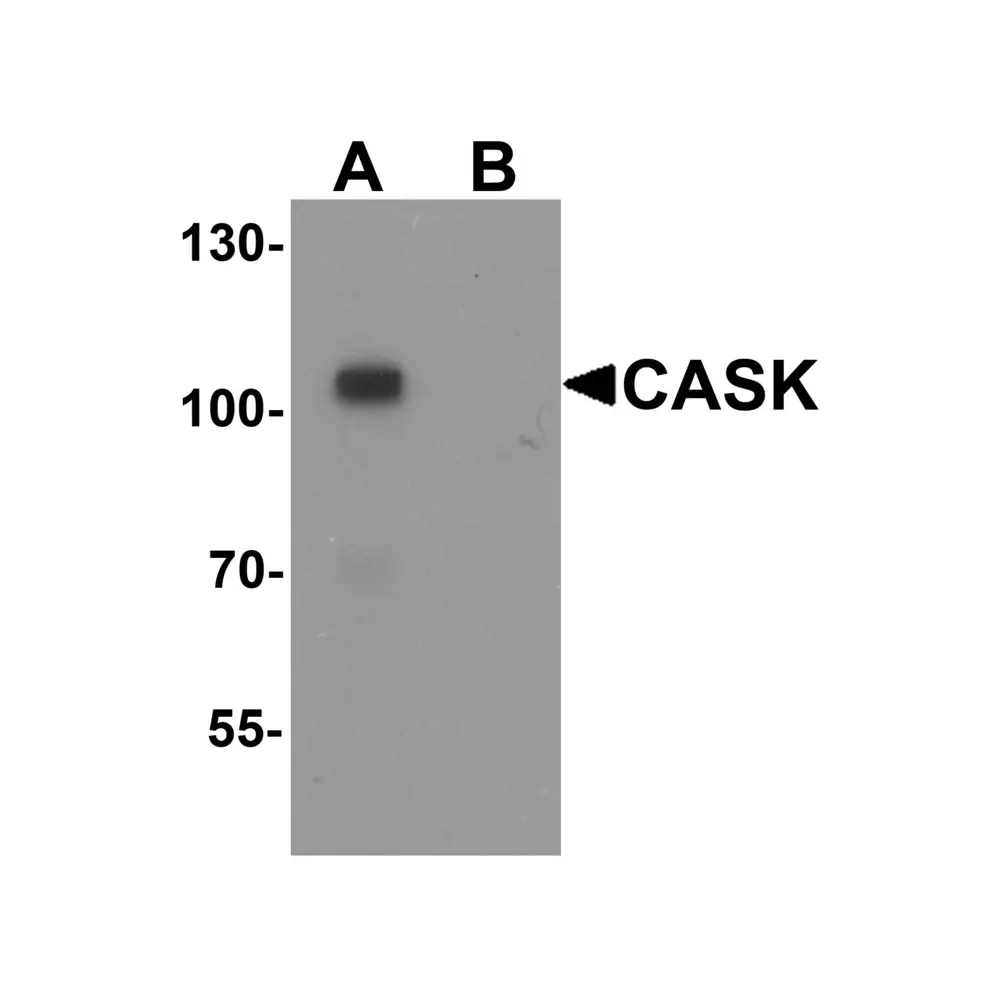 ProSci 6921 CASK Antibody, ProSci, 0.1 mg/Unit Primary Image