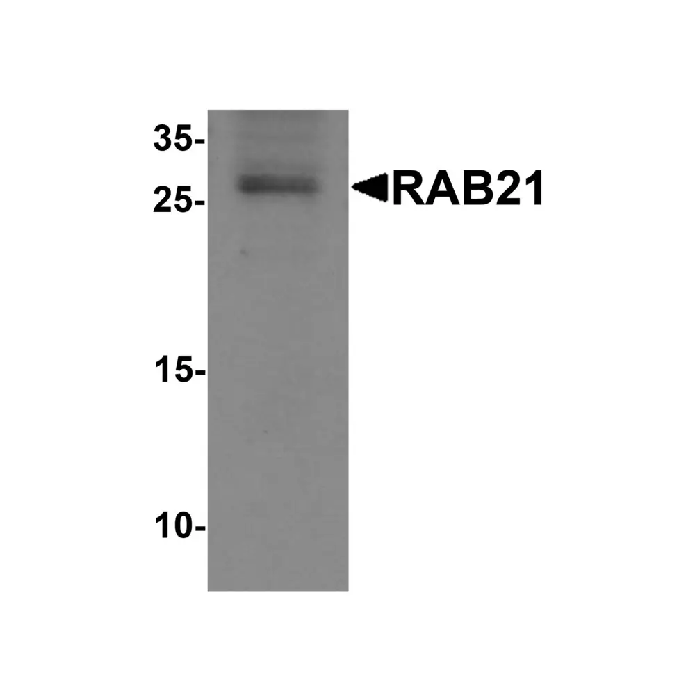 ProSci 6927 RAB21 Antibody, ProSci, 0.1 mg/Unit Primary Image