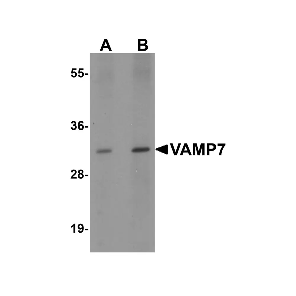 ProSci 6929 VAMP7 Antibody, ProSci, 0.1 mg/Unit Primary Image