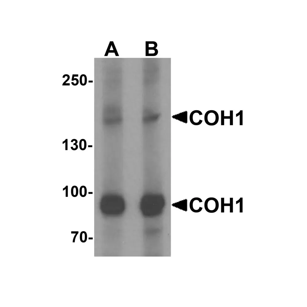ProSci 6931_S COH1 Antibody, ProSci, 0.02 mg/Unit Primary Image