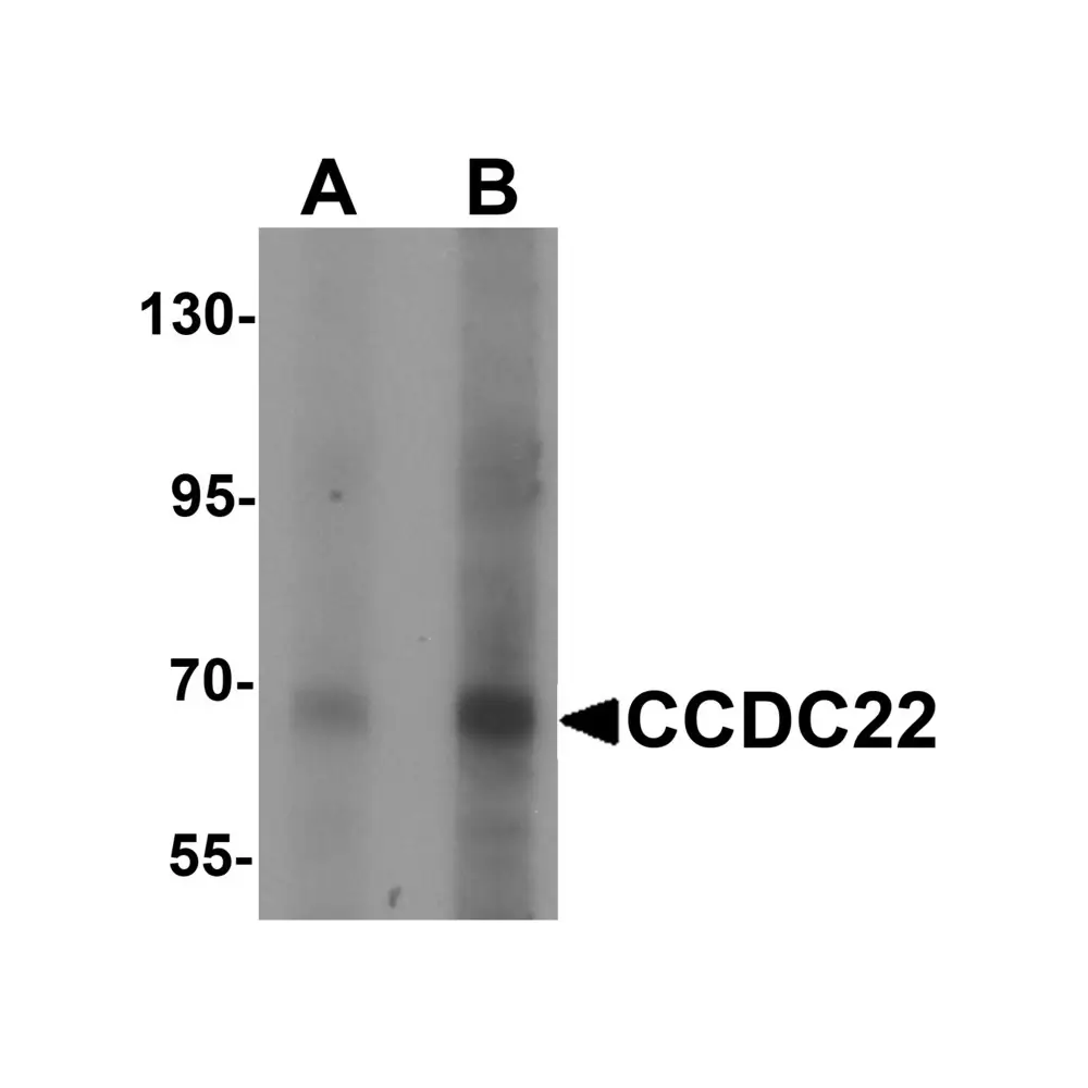 ProSci 6933 CCDC22 Antibody, ProSci, 0.1 mg/Unit Primary Image