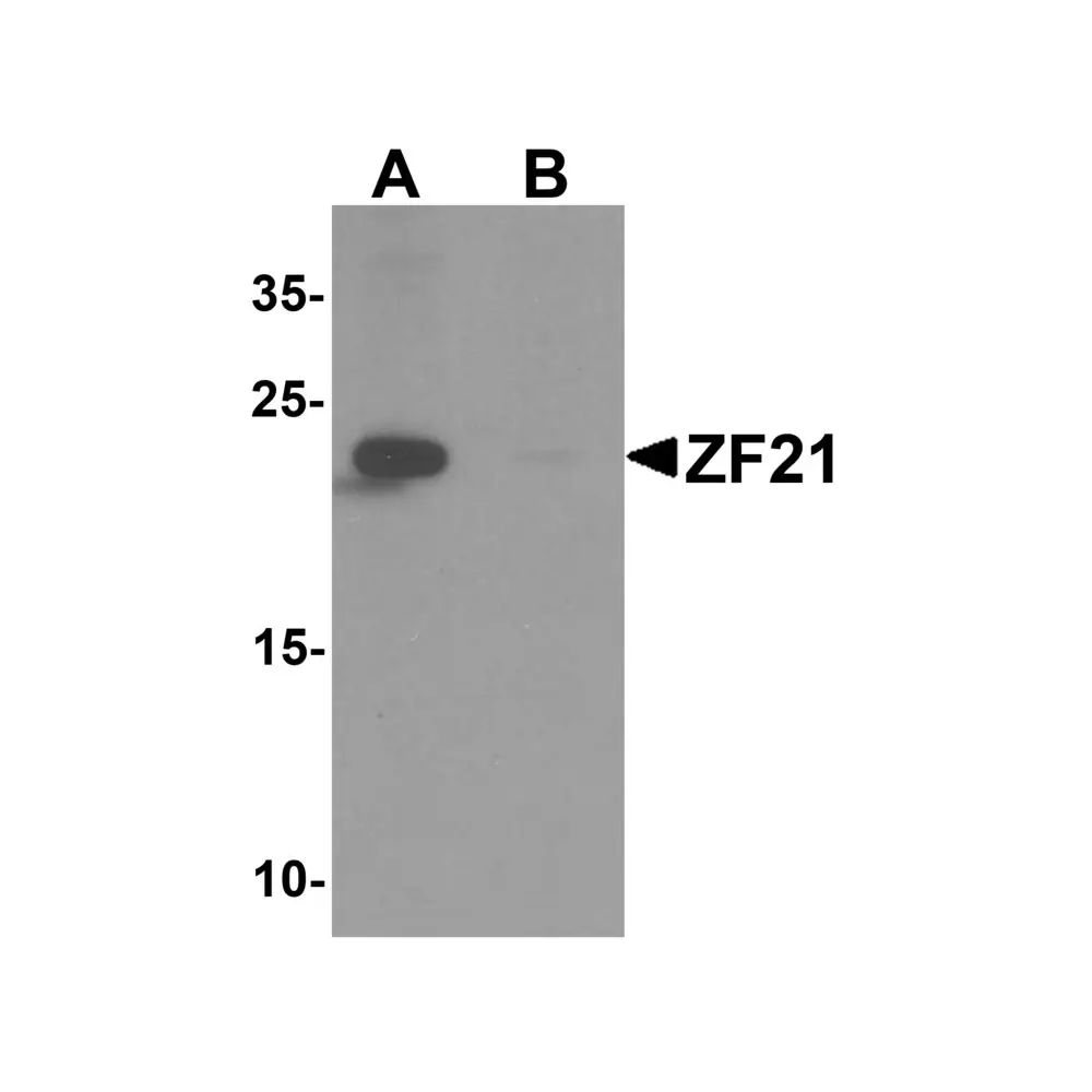 ProSci 6935_S ZF21 Antibody, ProSci, 0.02 mg/Unit Primary Image