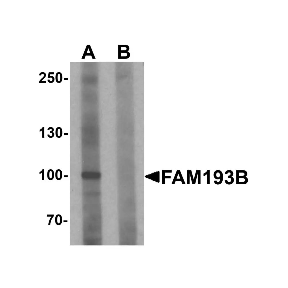 ProSci 6941_S FAM193B Antibody, ProSci, 0.02 mg/Unit Primary Image