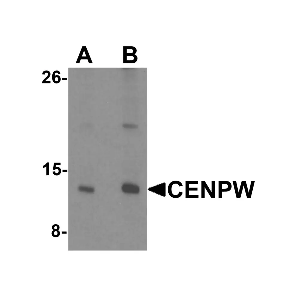 ProSci 6943_S CENPW Antibody, ProSci, 0.02 mg/Unit Primary Image