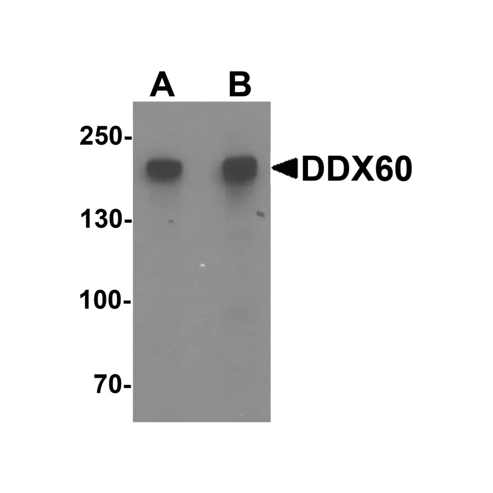 ProSci 6945 DDX60 Antibody, ProSci, 0.1 mg/Unit Primary Image