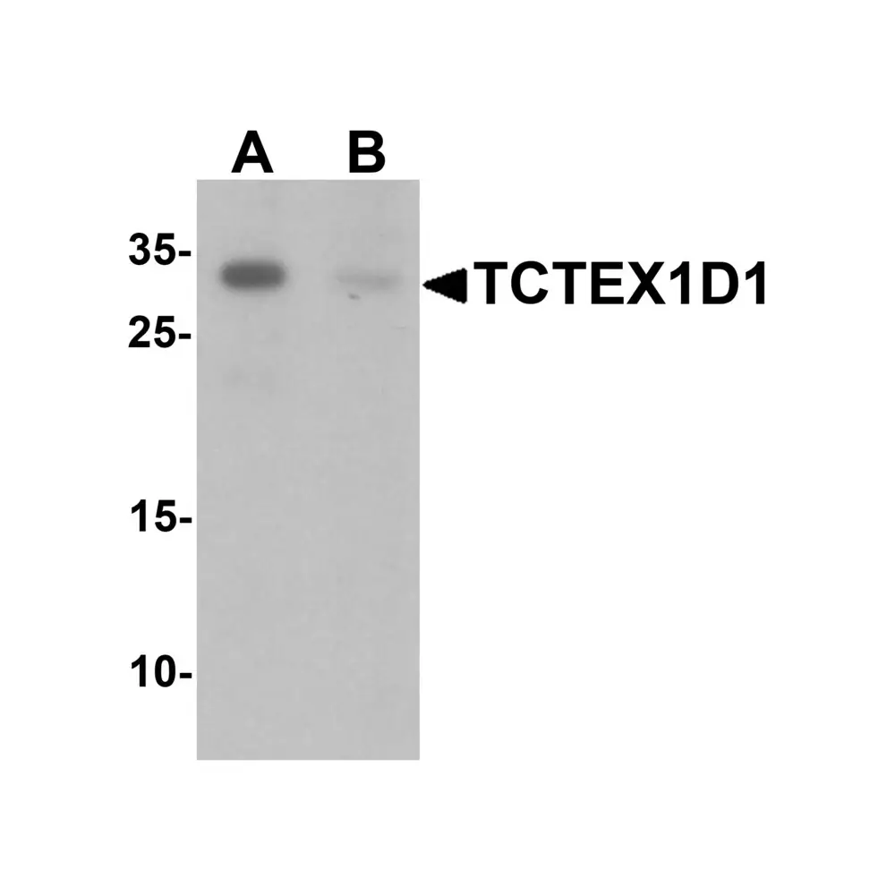 ProSci 6951 TCTEX1D1 Antibody, ProSci, 0.1 mg/Unit Primary Image