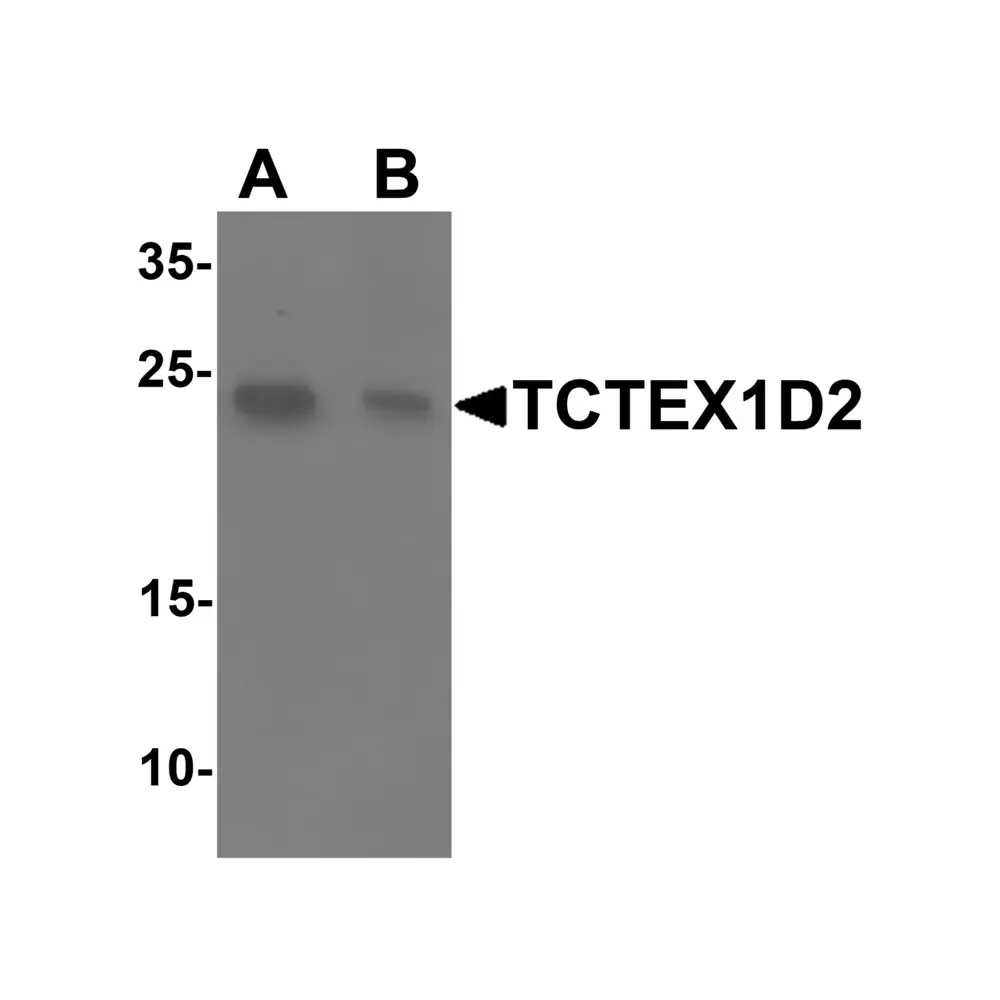 ProSci 6953_S TCTEX1D2 Antibody, ProSci, 0.02 mg/Unit Primary Image