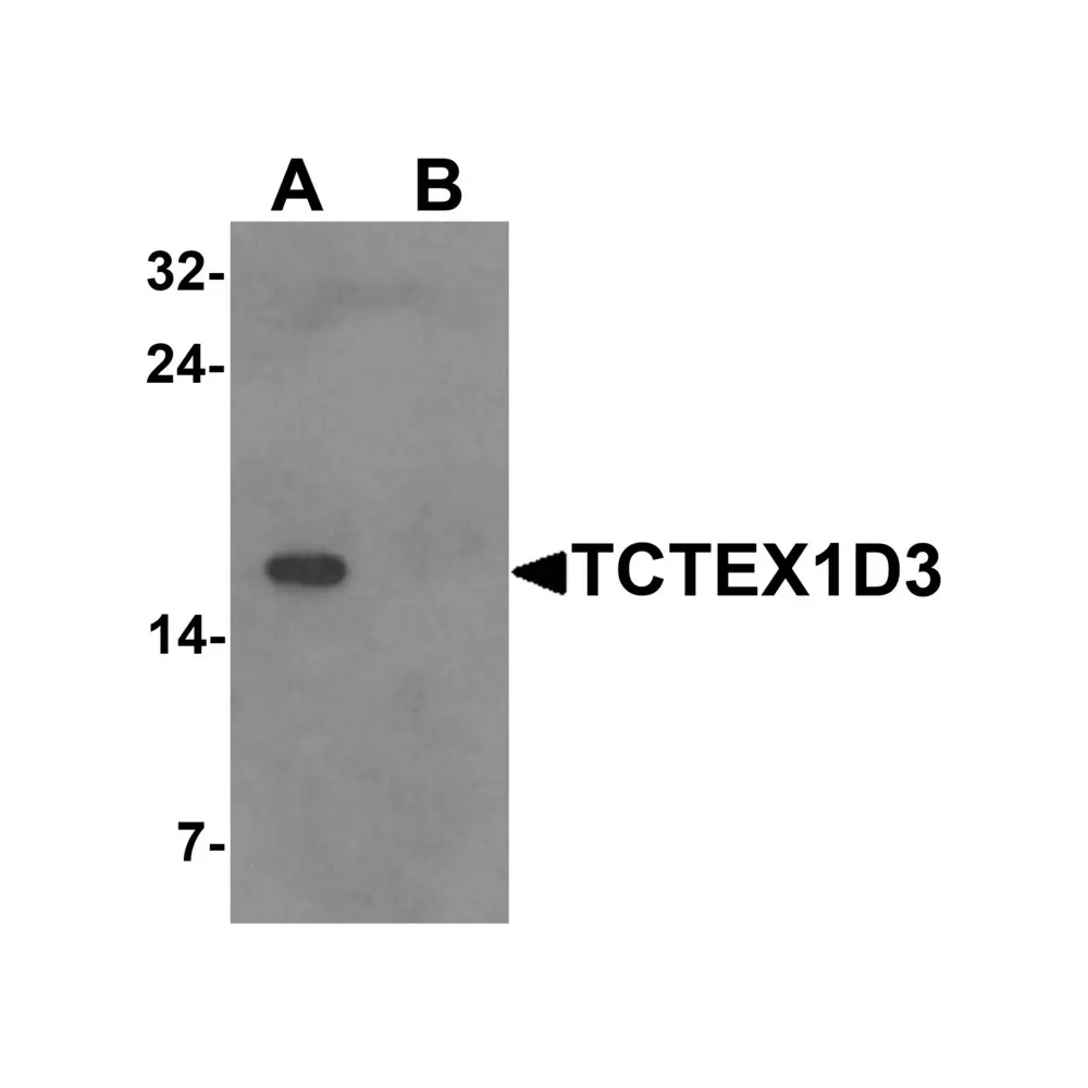 ProSci 6955_S TCTEX1D3 Antibody, ProSci, 0.02 mg/Unit Primary Image