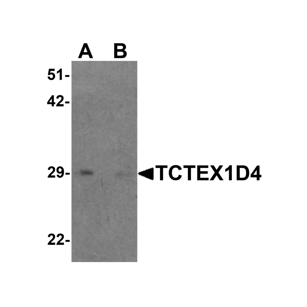 ProSci 6957_S TCTEX1D4 Antibody, ProSci, 0.02 mg/Unit Primary Image