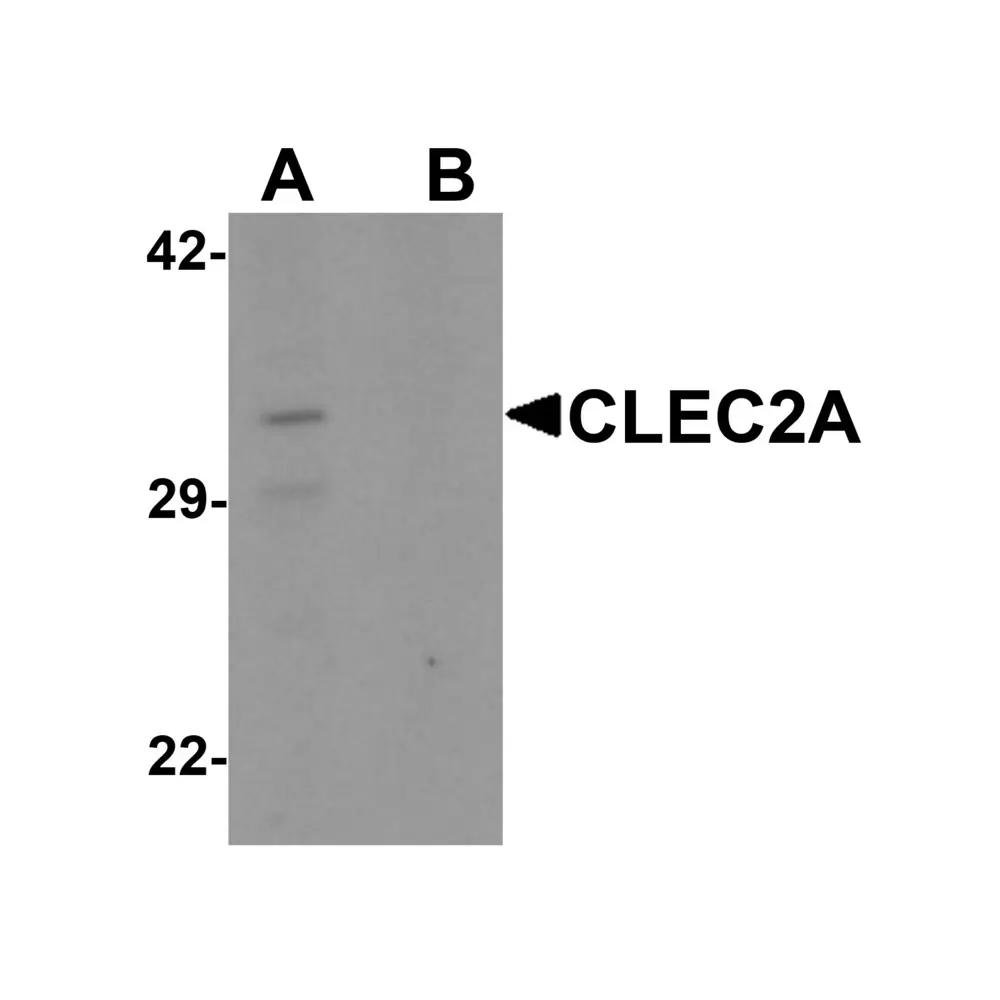 ProSci 6959 CLEC2A Antibody, ProSci, 0.1 mg/Unit Primary Image