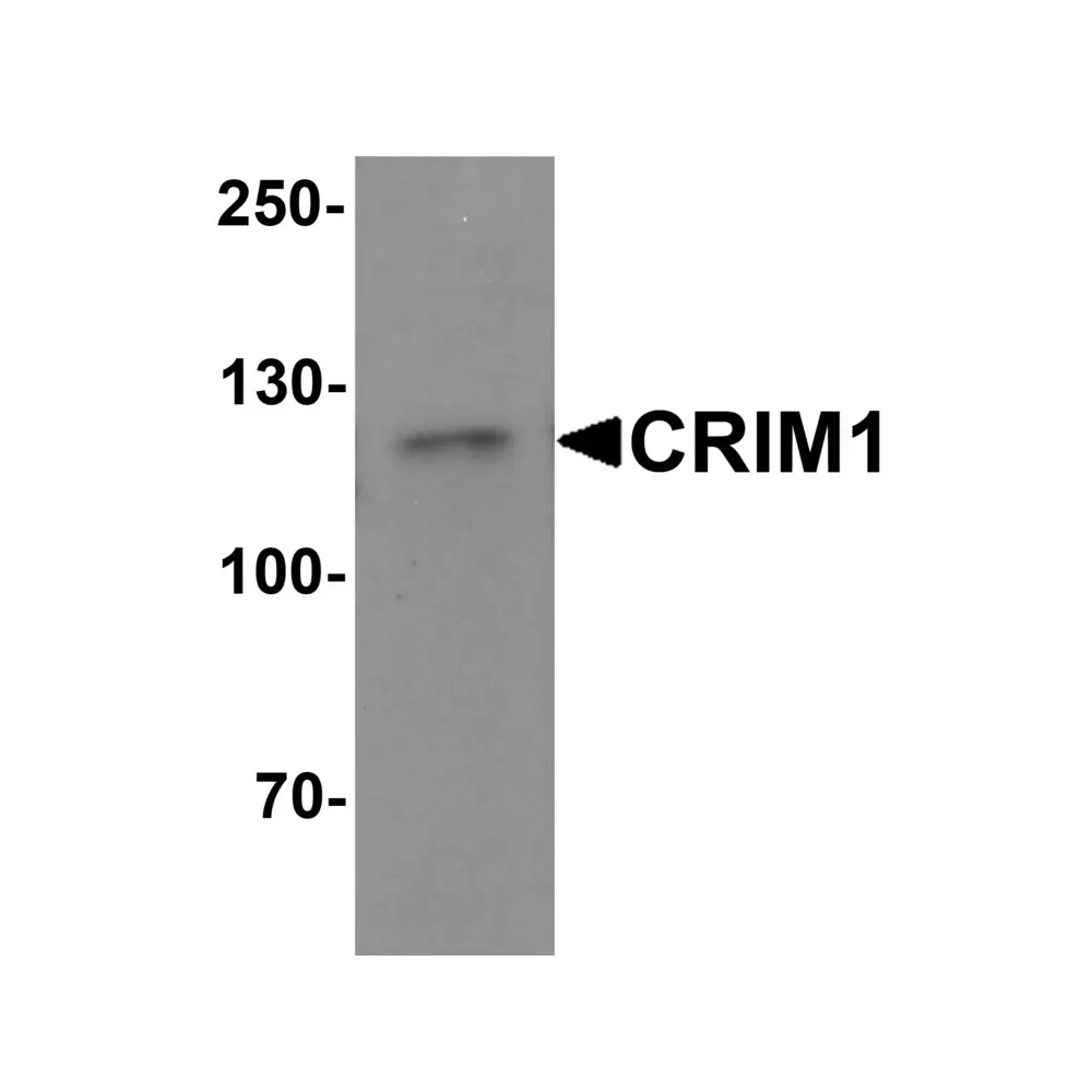 ProSci 6961_S CRIM1 Antibody, ProSci, 0.02 mg/Unit Primary Image