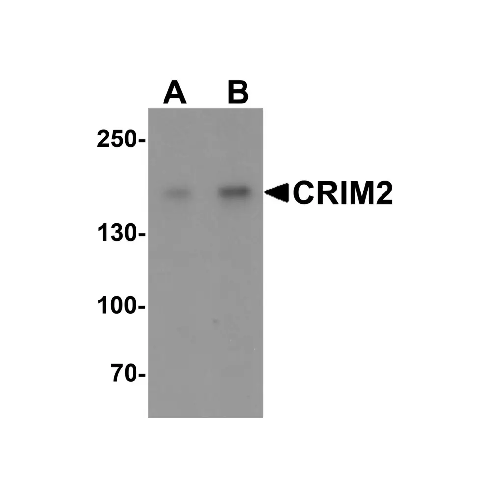 ProSci 6963 CRIM2 Antibody, ProSci, 0.1 mg/Unit Primary Image