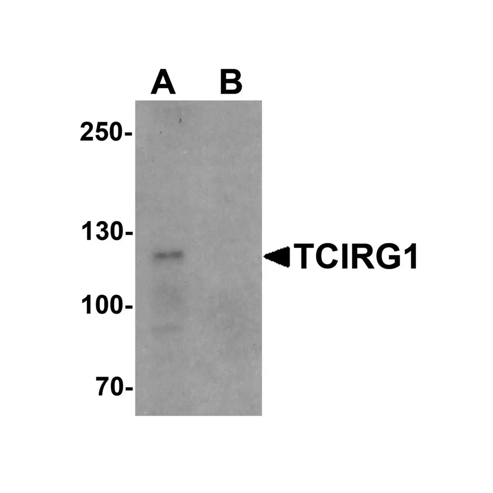 ProSci 6973 TCIRG1 Antibody, ProSci, 0.1 mg/Unit Primary Image