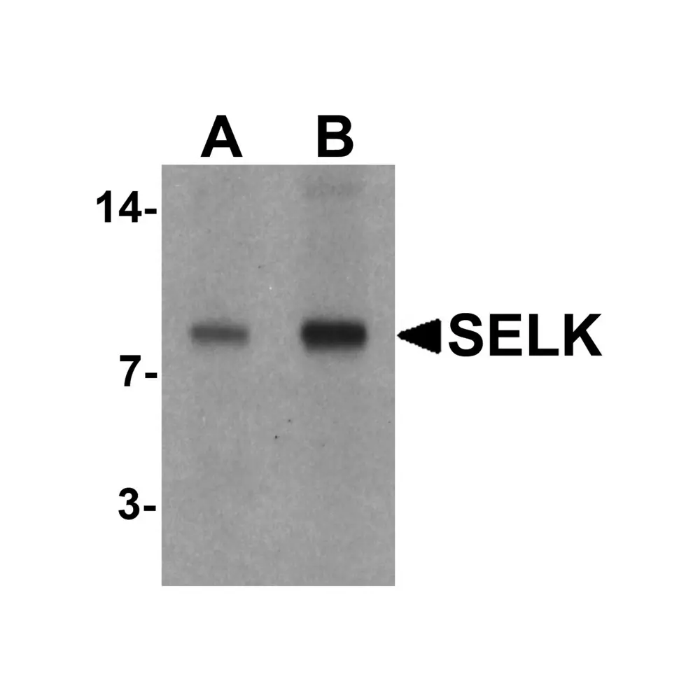 ProSci 6975_S SELK Antibody, ProSci, 0.02 mg/Unit Primary Image