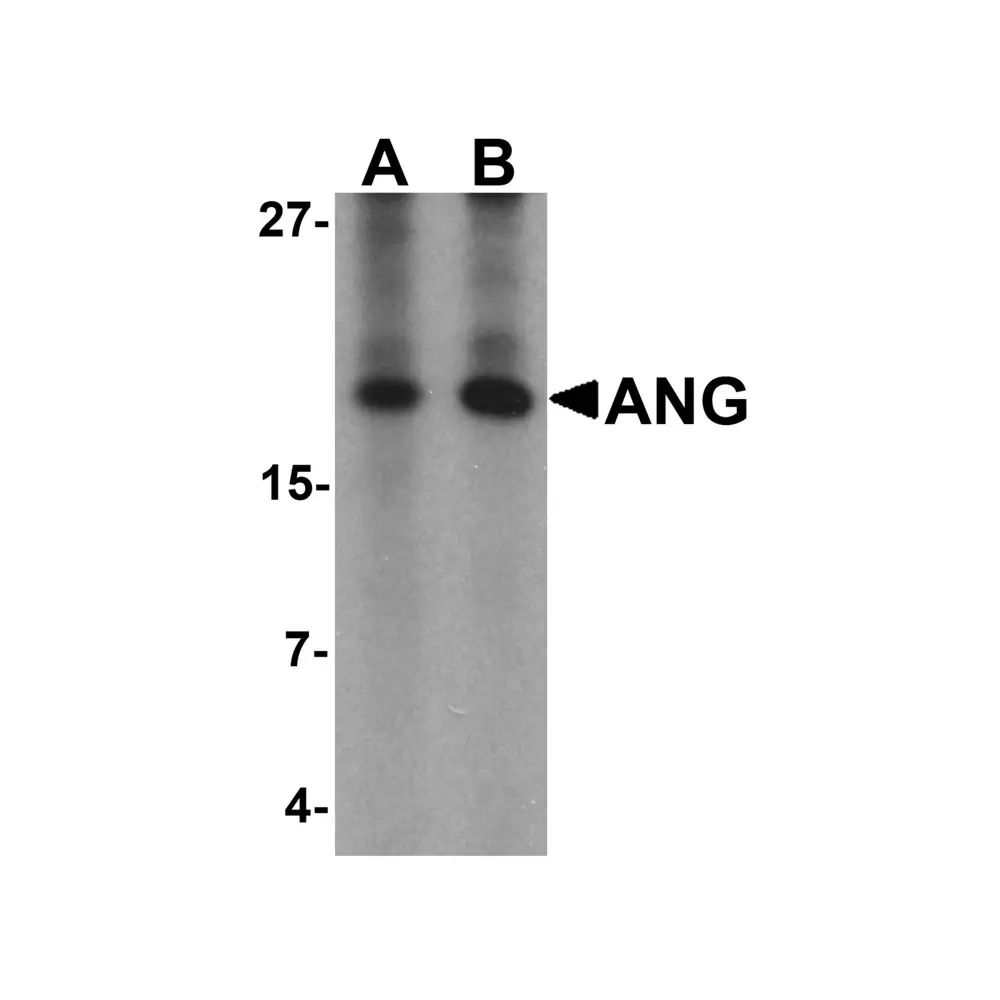 ProSci 6983_S ANG Antibody, ProSci, 0.02 mg/Unit Primary Image