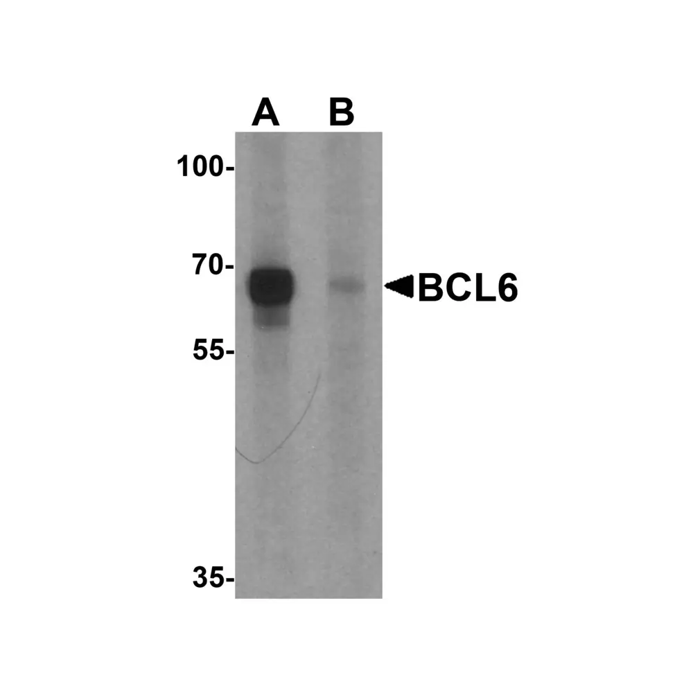 ProSci 6985 BCL6 Antibody, ProSci, 0.1 mg/Unit Primary Image