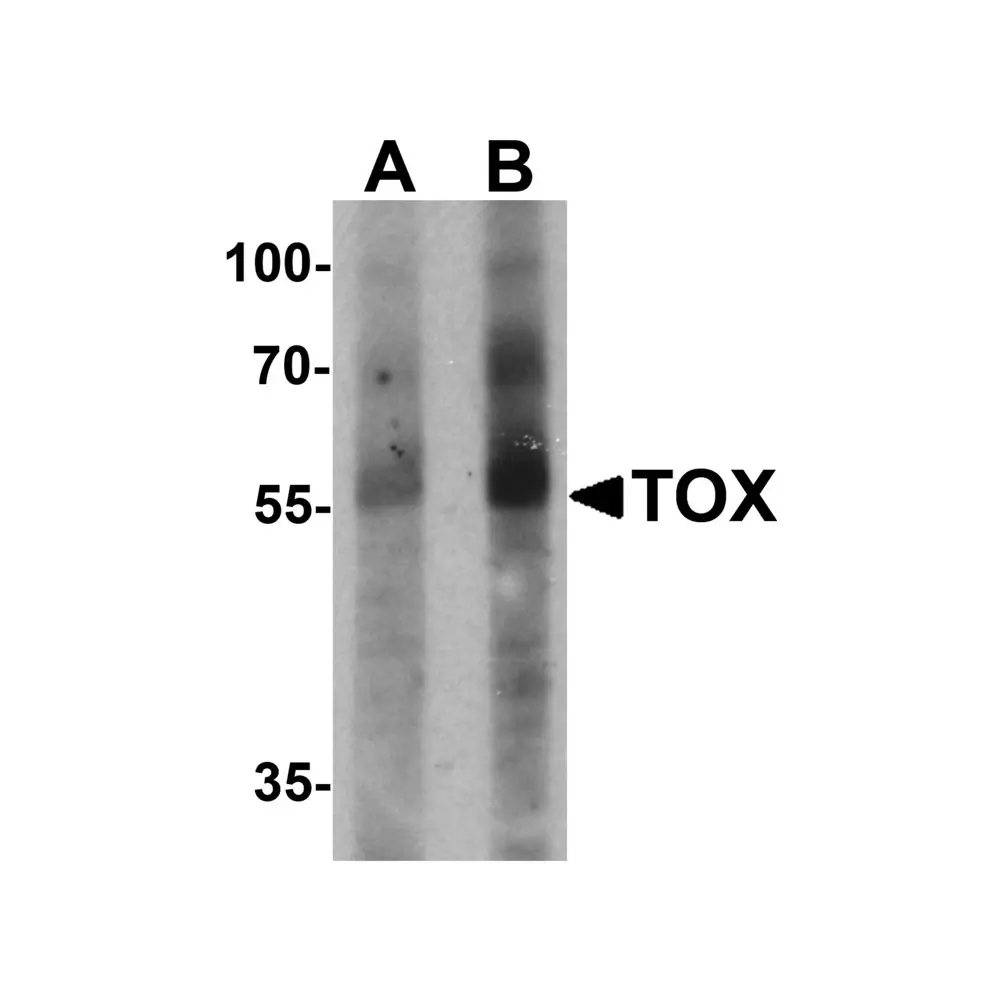 ProSci 6987 TOX Antibody, ProSci, 0.1 mg/Unit Primary Image