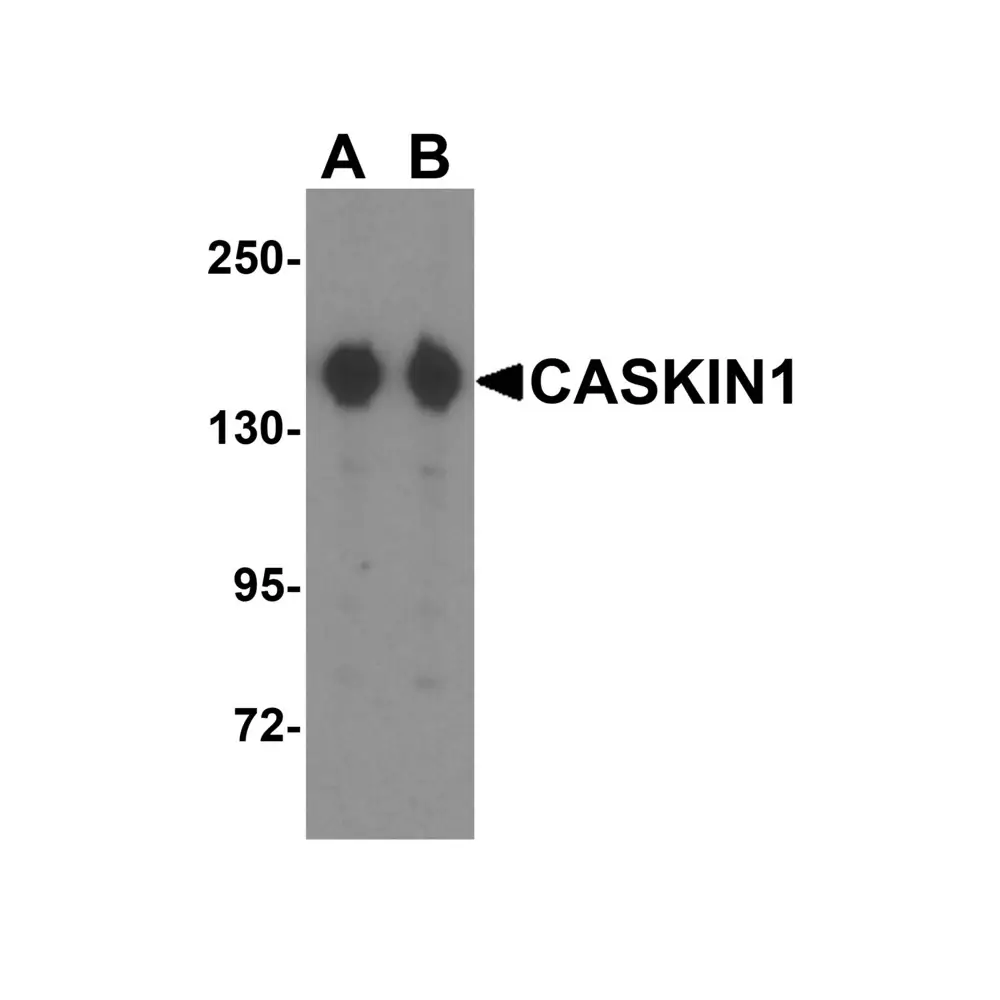 ProSci 6991 CASKIN1 Antibody, ProSci, 0.1 mg/Unit Primary Image