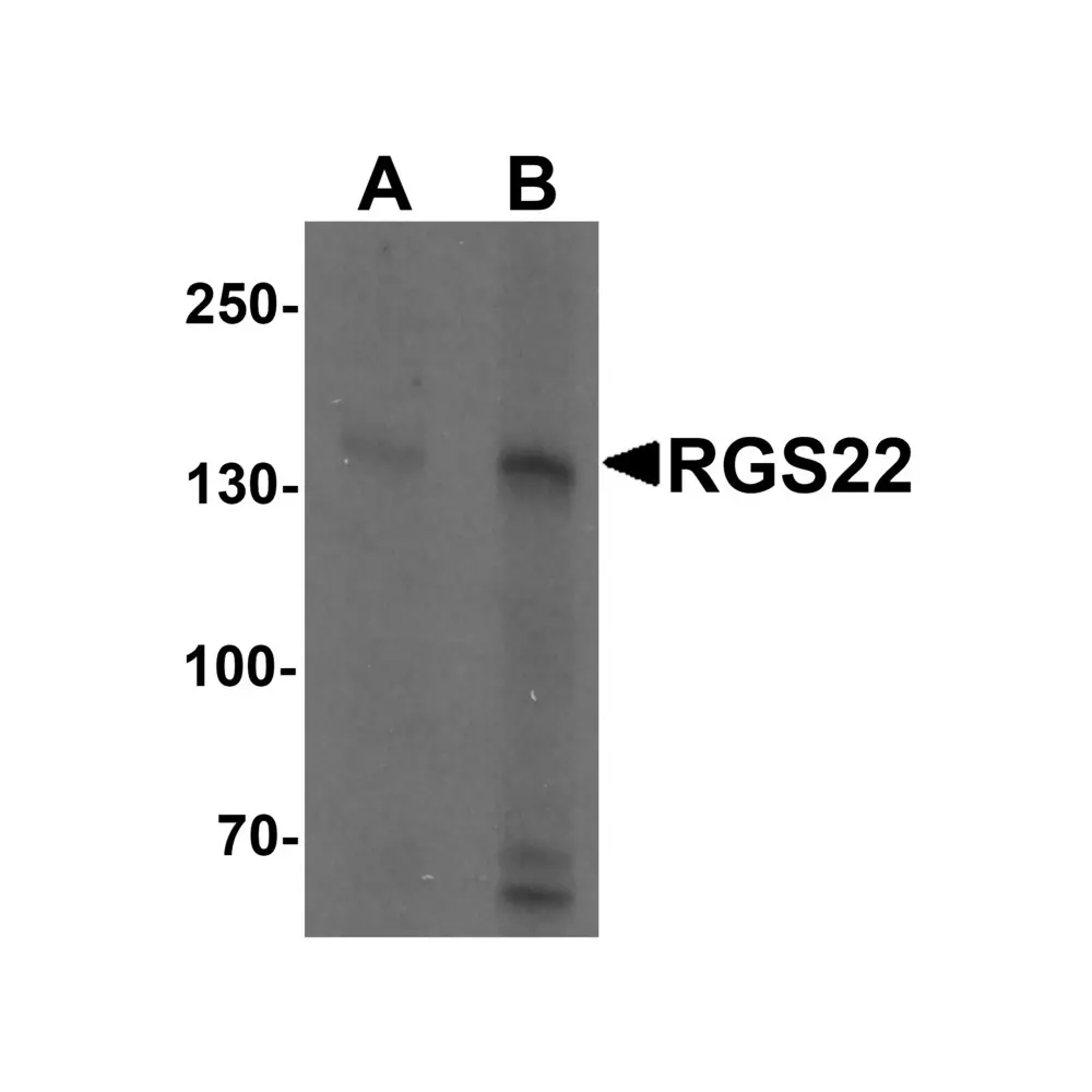 ProSci 7001_S RGS22 Antibody, ProSci, 0.02 mg/Unit Primary Image