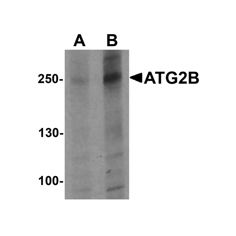 ProSci 7005_S ATG2B Antibody, ProSci, 0.02 mg/Unit Primary Image