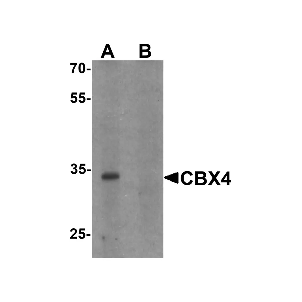 ProSci 7007 CBX4 Antibody, ProSci, 0.1 mg/Unit Primary Image
