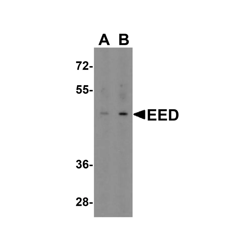 ProSci 7009 EED Antibody, ProSci, 0.1 mg/Unit Primary Image
