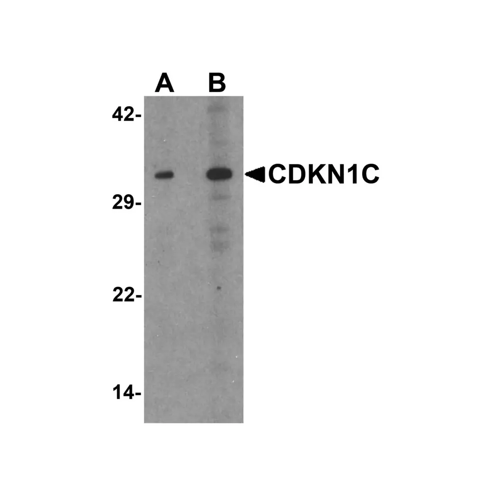 ProSci 7015_S CDKN1C Antibody, ProSci, 0.02 mg/Unit Primary Image