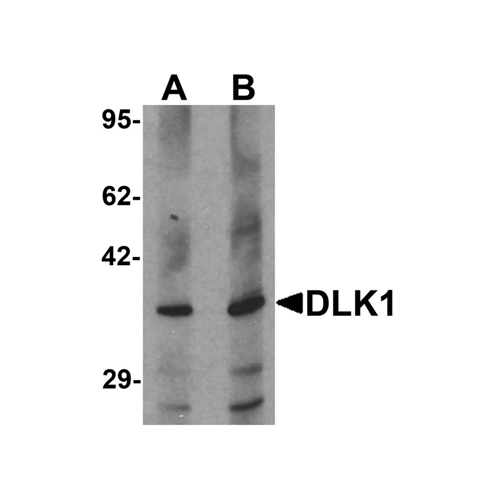 ProSci 7017_S DLK1 Antibody, ProSci, 0.02 mg/Unit Primary Image