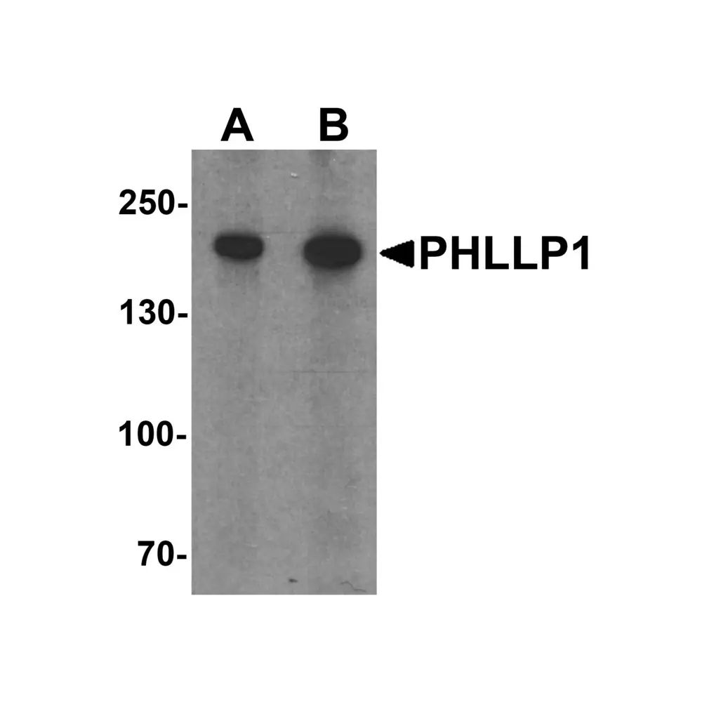 ProSci 7019_S PHLPP1 Antibody, ProSci, 0.02 mg/Unit Primary Image