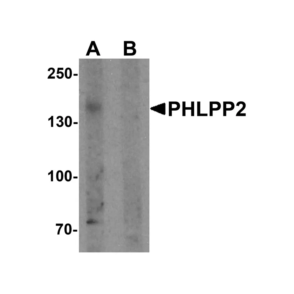 ProSci 7021 PHLPP2 Antibody, ProSci, 0.1 mg/Unit Primary Image