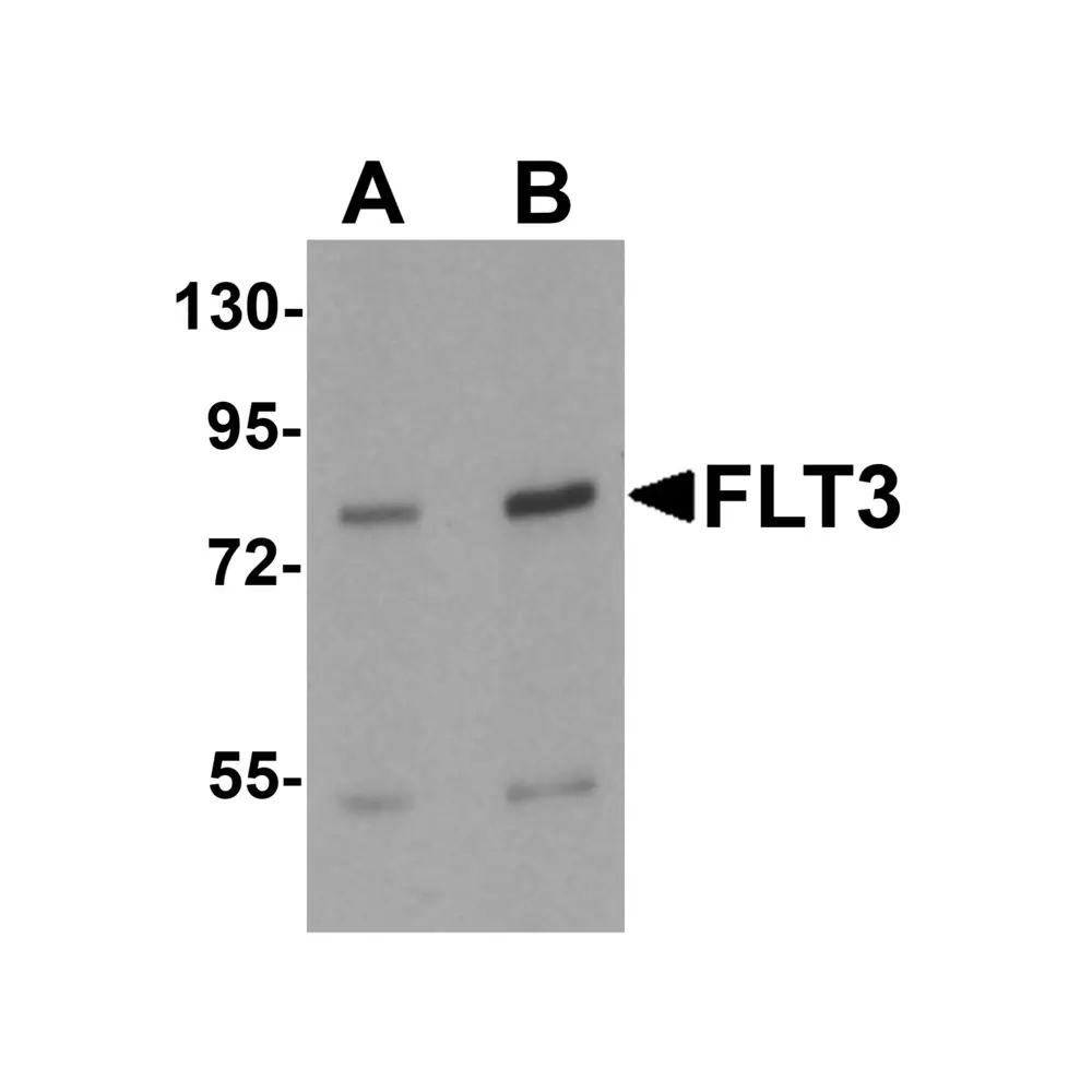 ProSci 7027 FLT3 Antibody, ProSci, 0.1 mg/Unit Primary Image