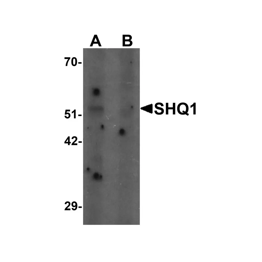 ProSci 7029 SHQ1 Antibody, ProSci, 0.1 mg/Unit Primary Image