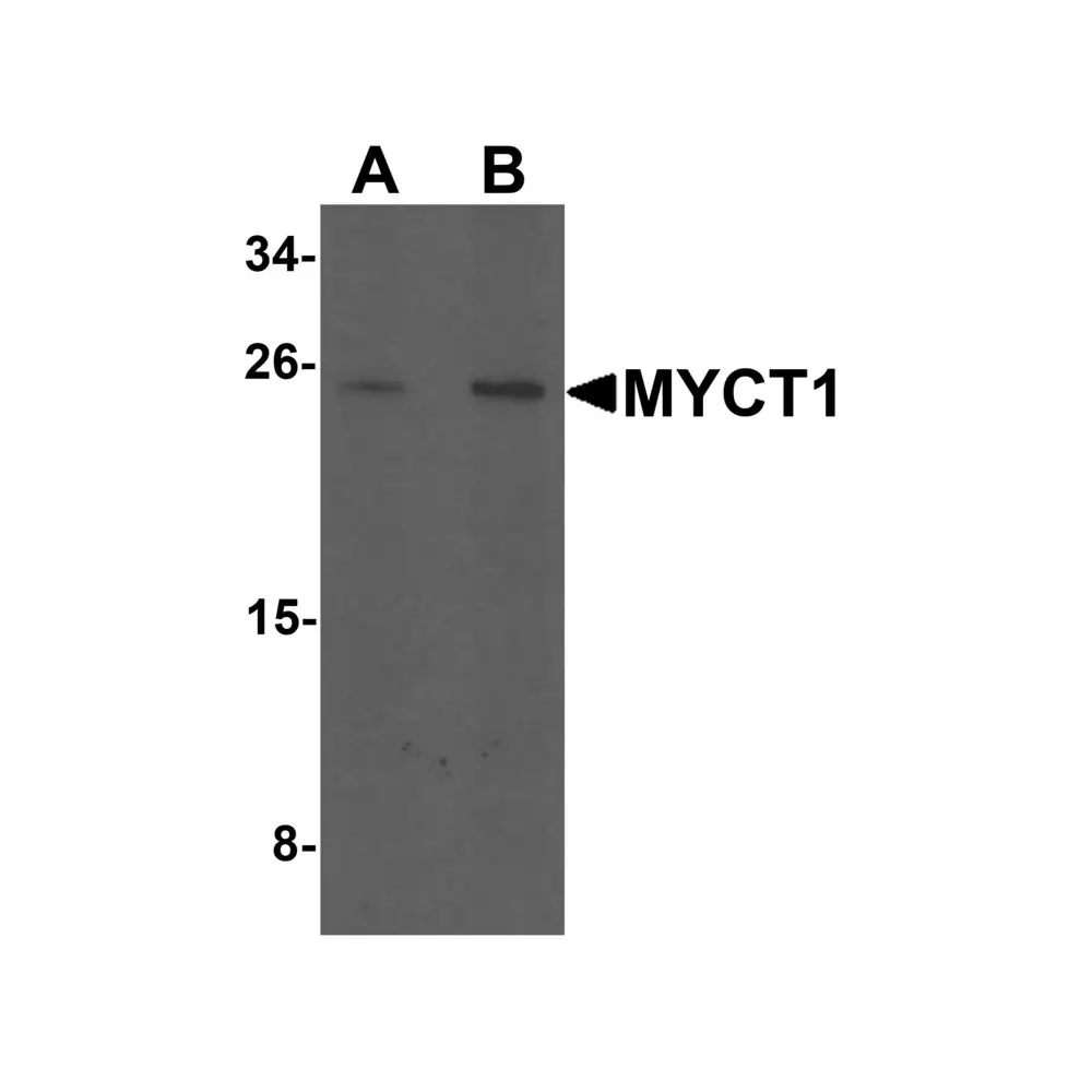ProSci 7031 MYCT1 Antibody, ProSci, 0.1 mg/Unit Primary Image