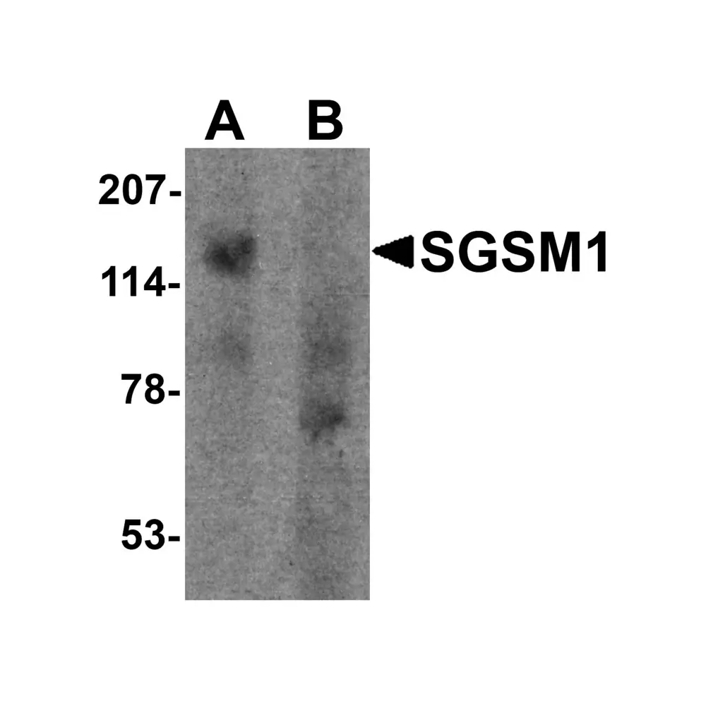 ProSci 7033_S SGSM1 Antibody, ProSci, 0.02 mg/Unit Primary Image