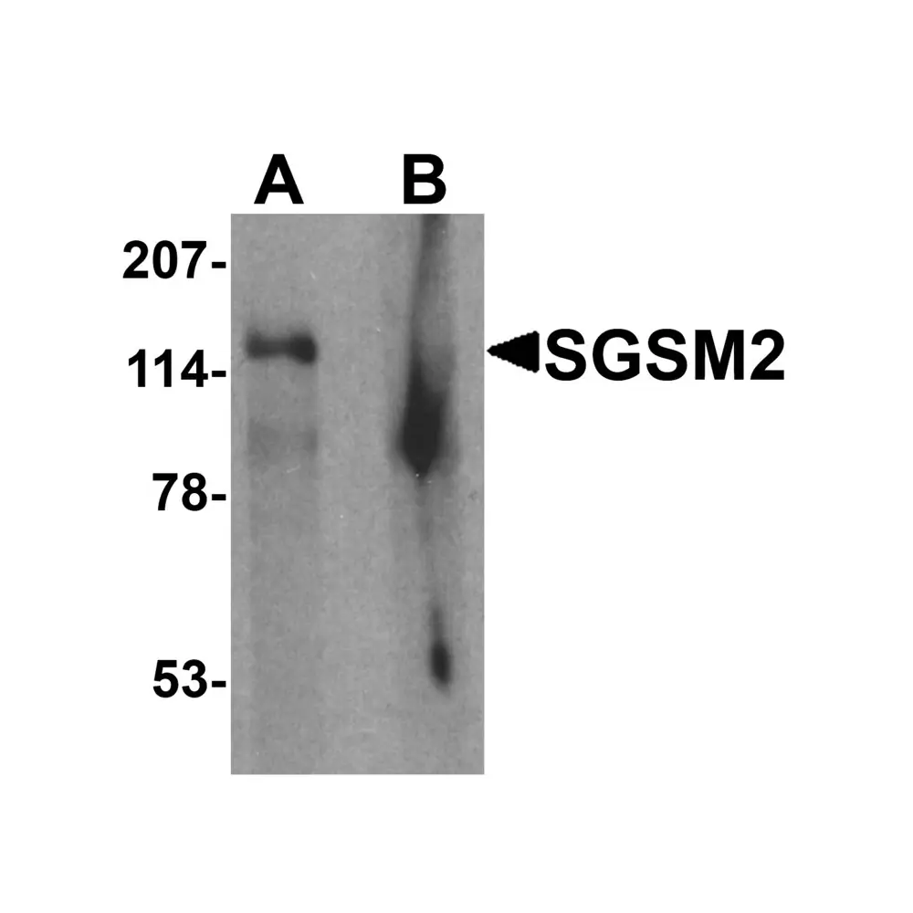 ProSci 7035 SGSM2 Antibody, ProSci, 0.1 mg/Unit Primary Image
