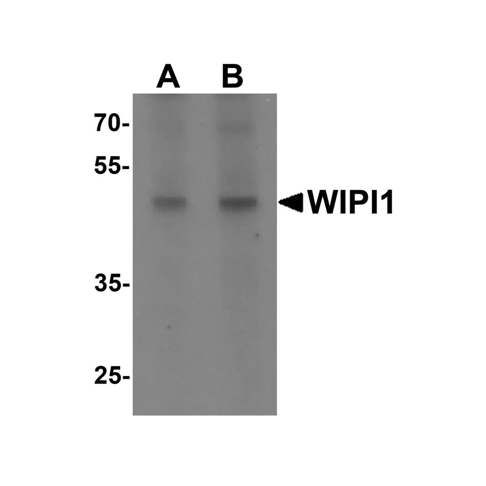 ProSci 7041 WIPI1 Antibody, ProSci, 0.1 mg/Unit Primary Image