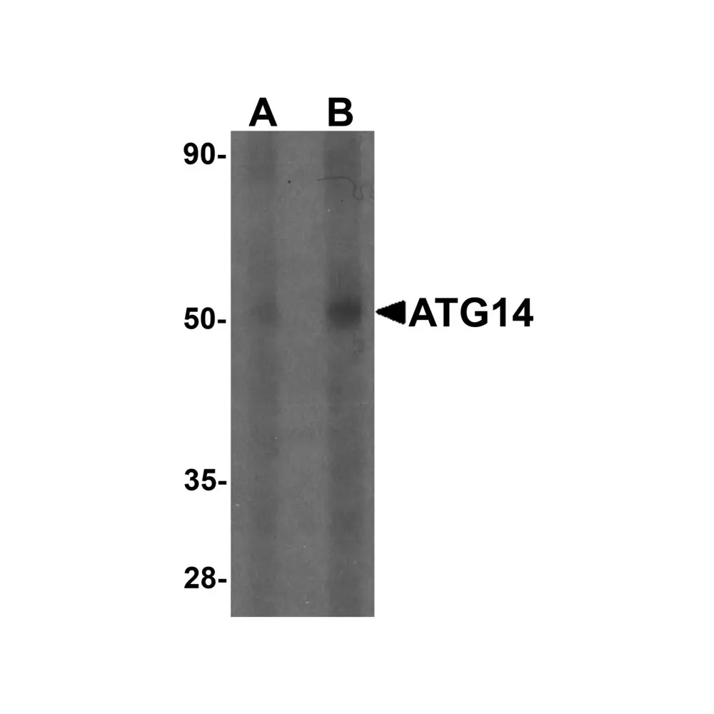 ProSci 7043 ATG14 Antibody, ProSci, 0.1 mg/Unit Primary Image