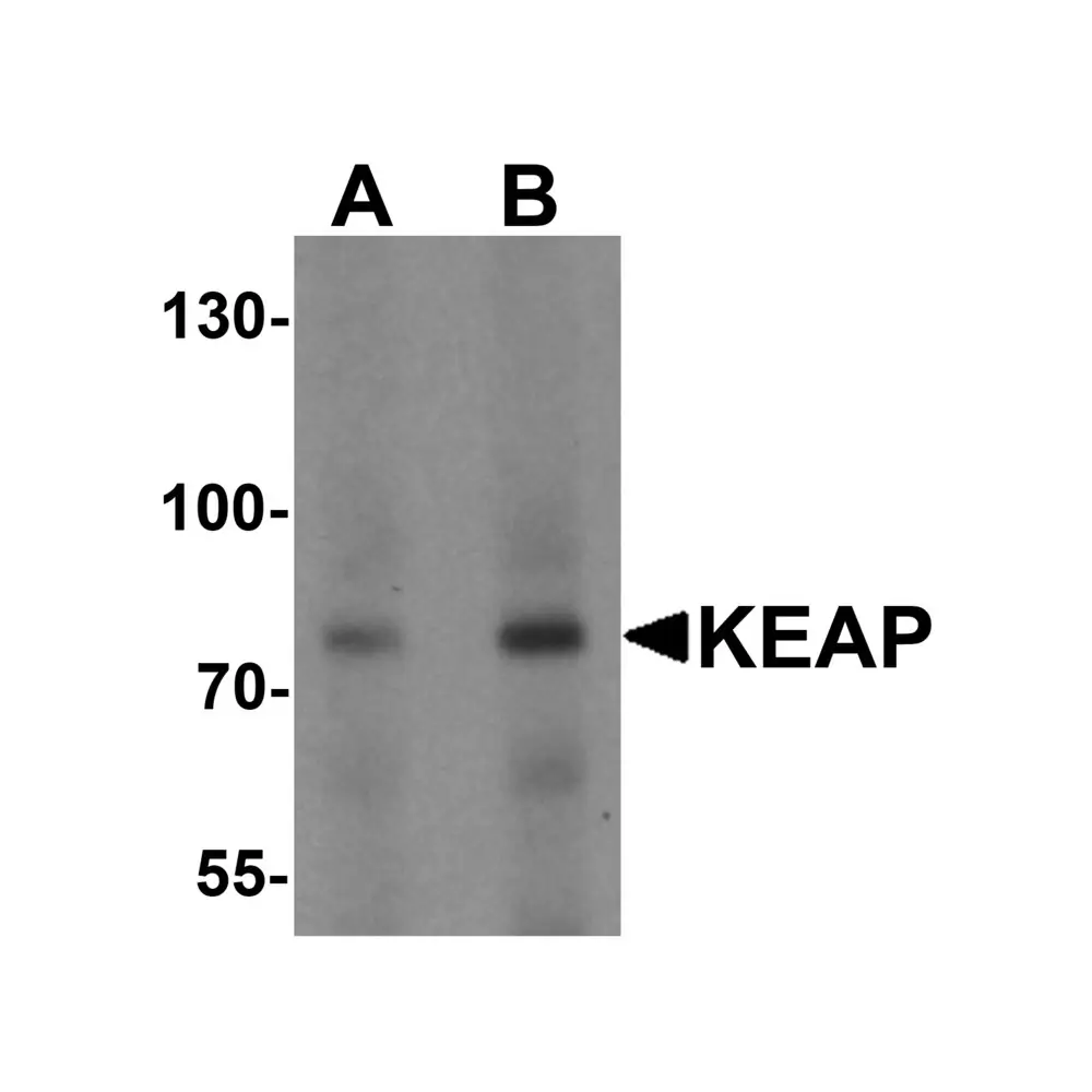 ProSci 7045 KEAP1 Antibody, ProSci, 0.1 mg/Unit Primary Image